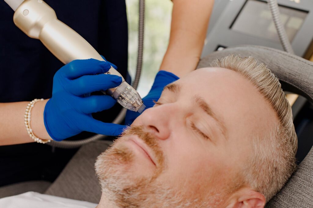 How To Maximize Your Results And Recovery After Sylfirm X Treatment