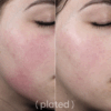 Plated daily serum - Image 3