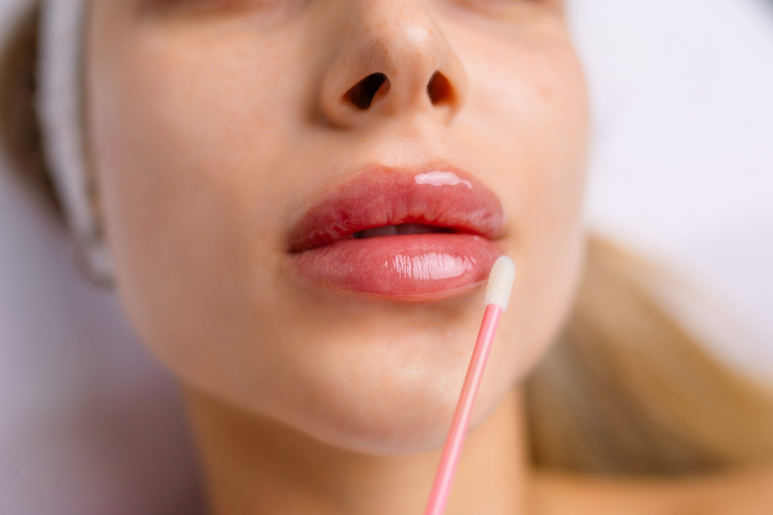 lip filler cost